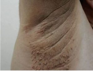 HT10. These are the first symptoms of cr…See more
