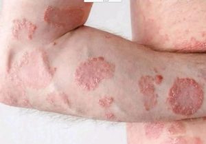 These are the consequences of sleeping with the… See more